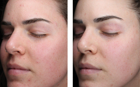 AlphaRet Clearing Serum