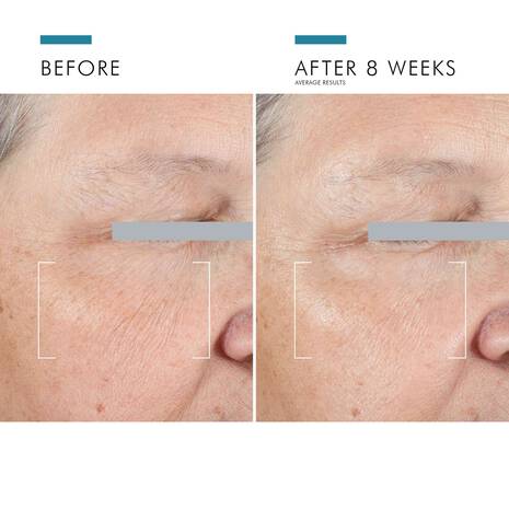 A.G.E. Advanced Eye for Dark Circles