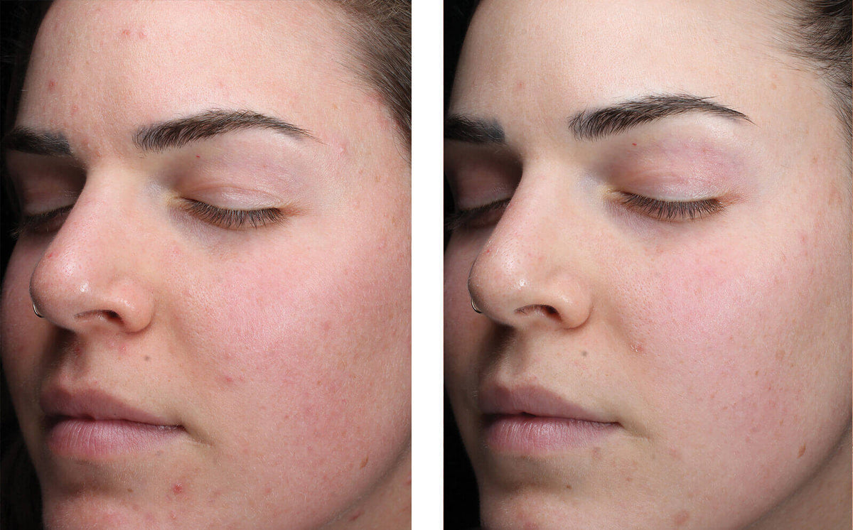 AlphaRet Clearing Serum
