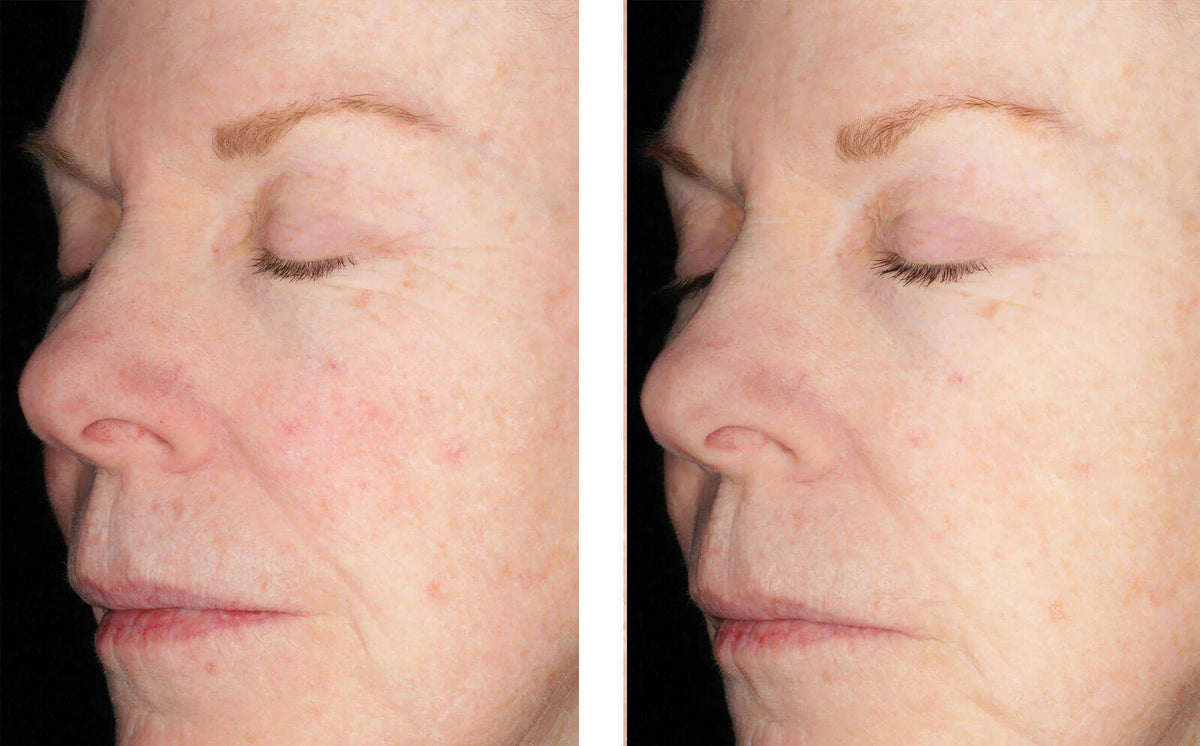 Alto Defense Serum
