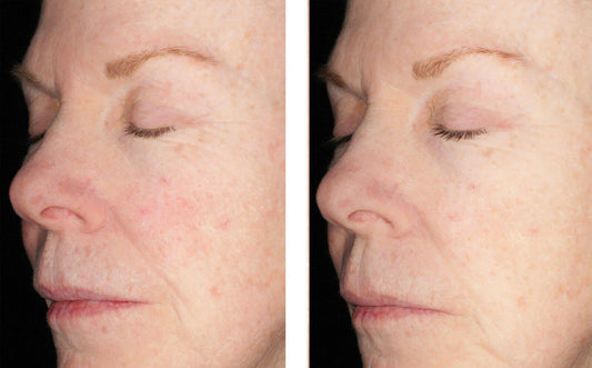 Alto Defense Serum