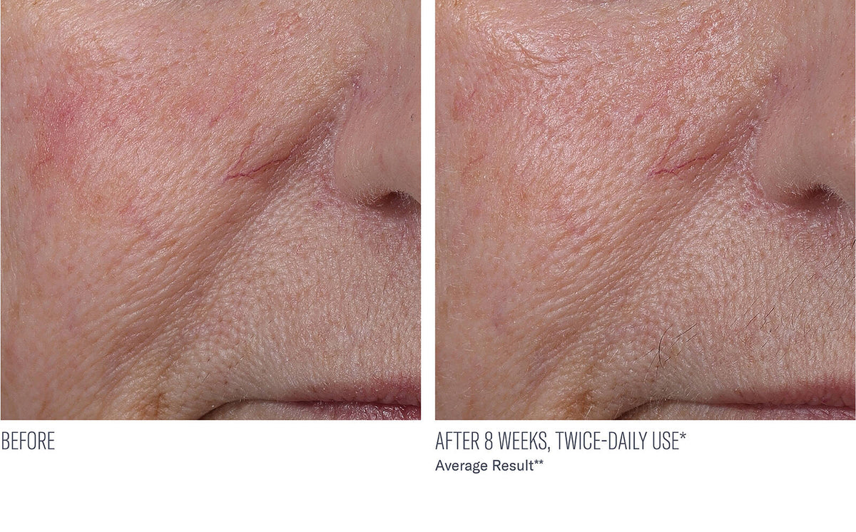 InterFuse Treatment Cream Face + Neck