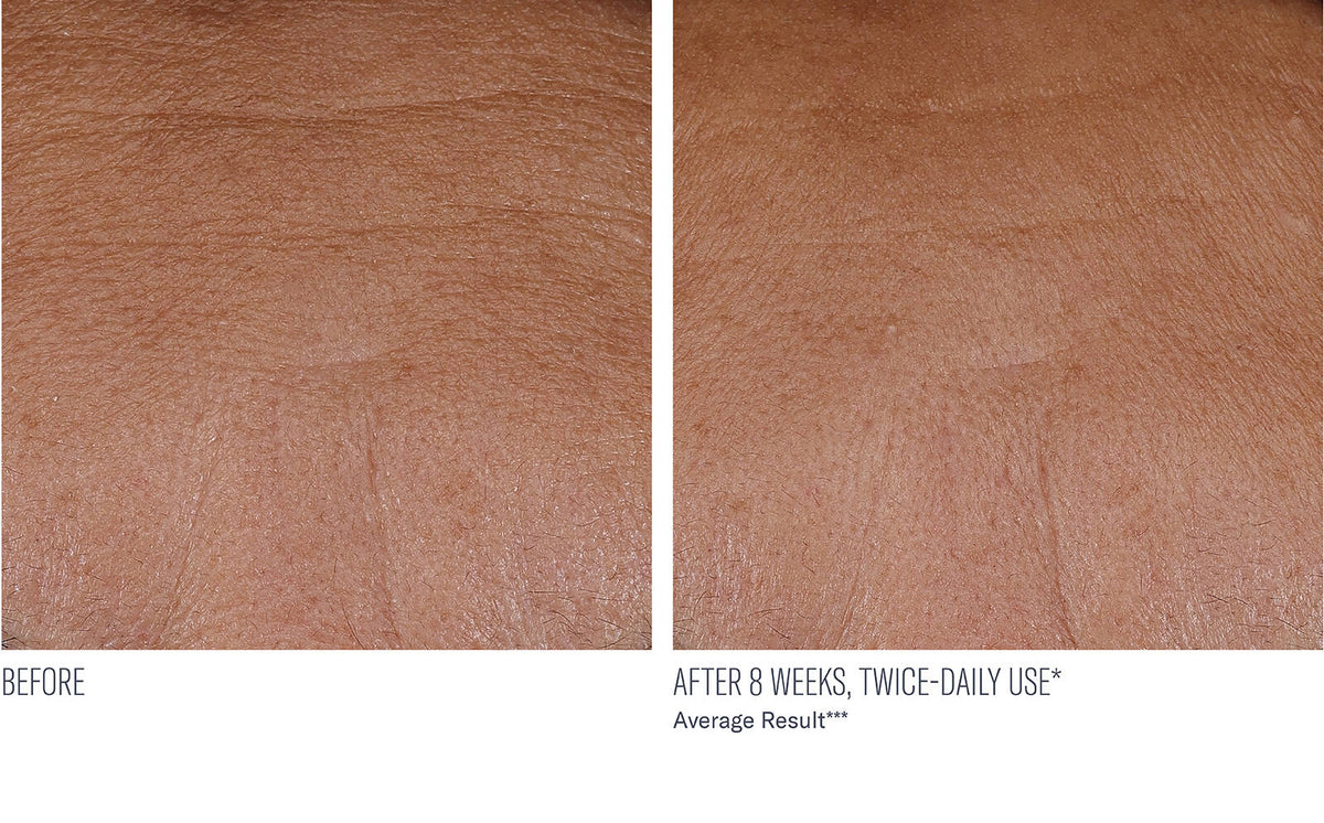 InterFuse Treatment Cream Face + Neck