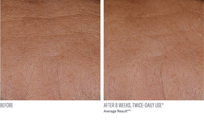InterFuse Treatment Cream Face + Neck
