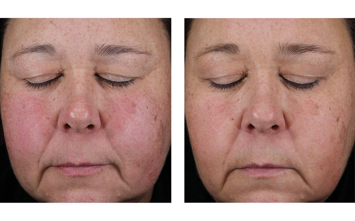 Mystro Active Balance Serum