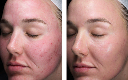 sunbetter TONE SMART SPF 75 Sunscreen Lotion